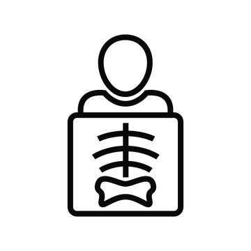 X-Ray